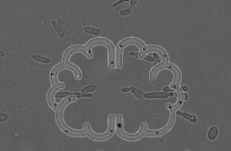 Hablemos de infecciones causadas por hongos: la esporotricosis