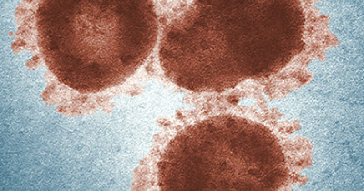 México cuenta con buen soporte para el diagnóstico del coronavirus: experto UG