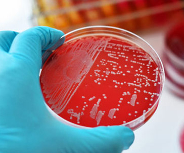 superbacterias-resistentes-antibioticos-insp-