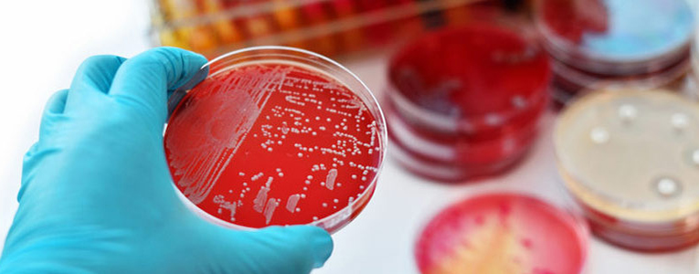 superbacterias-resistentes-antibioticos-insp