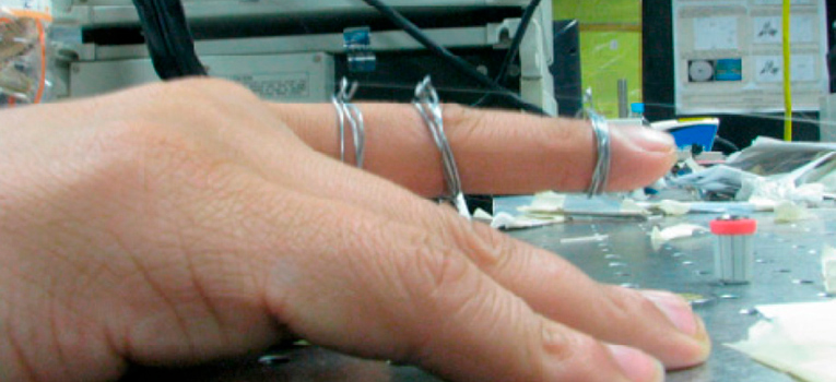 Universitarios patentan sistema para detección del movimiento de una mano con aplicaciones biónicas y biotecnológicas | Universidad de Guanajuato (UG, UGTO) sistema-deteccion-movimiento-mano-universidad-guanajuato-ug-ugto-1